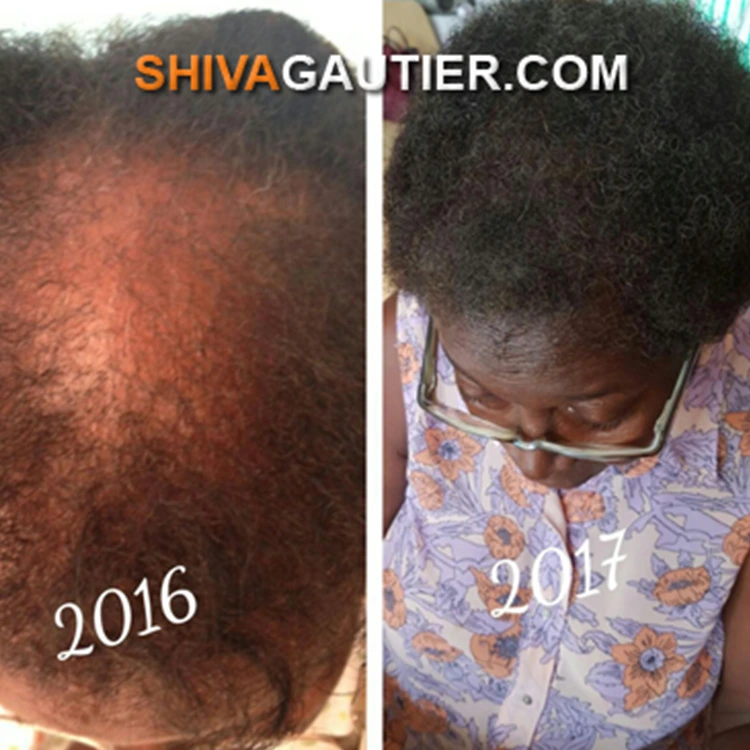 Temoignage-5-Shiva-gautier-qui-sommes-nous-produits-capillaires-cheveux-serum-antichute-pommade-masque-hydrate